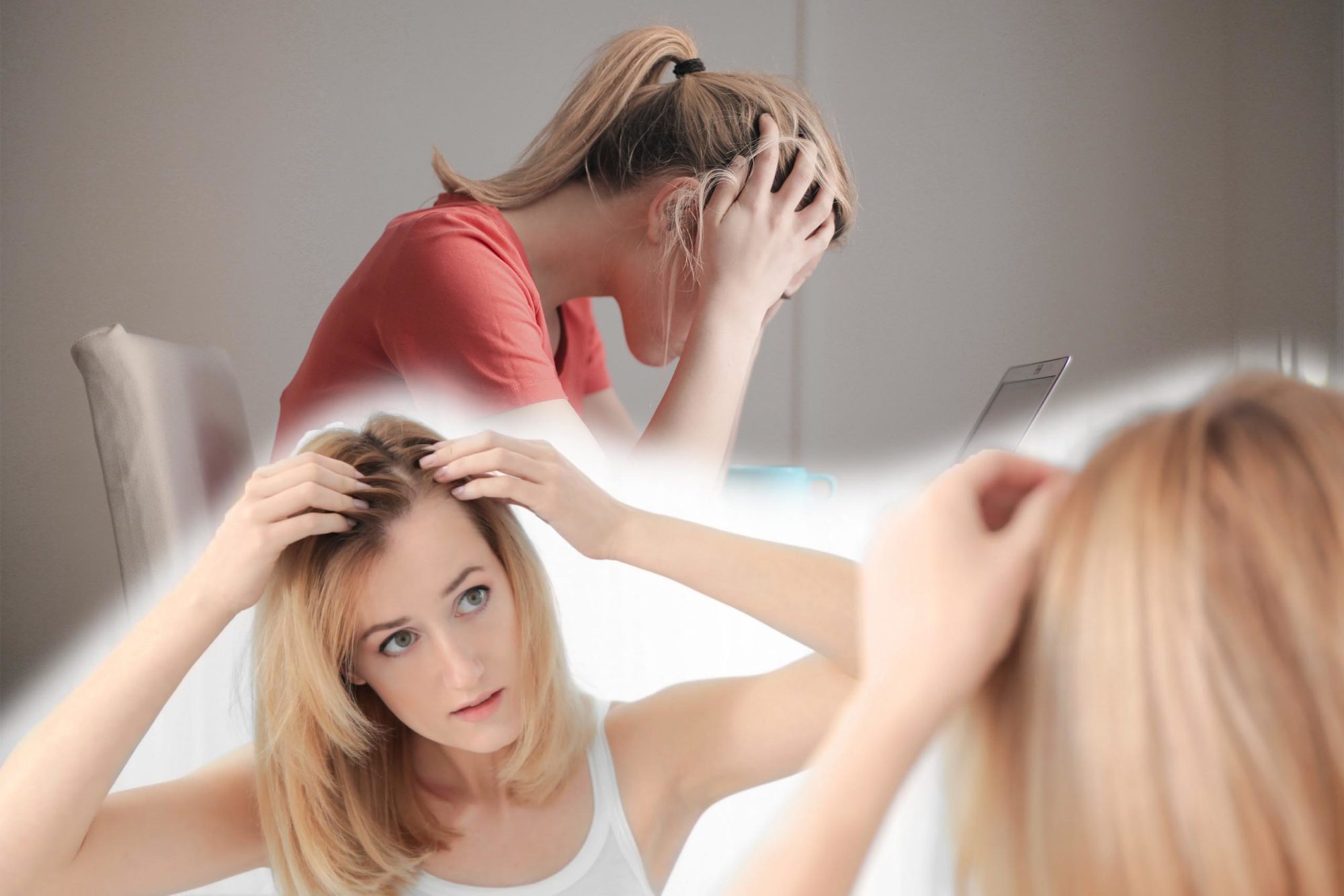  The downsides of hair loss 