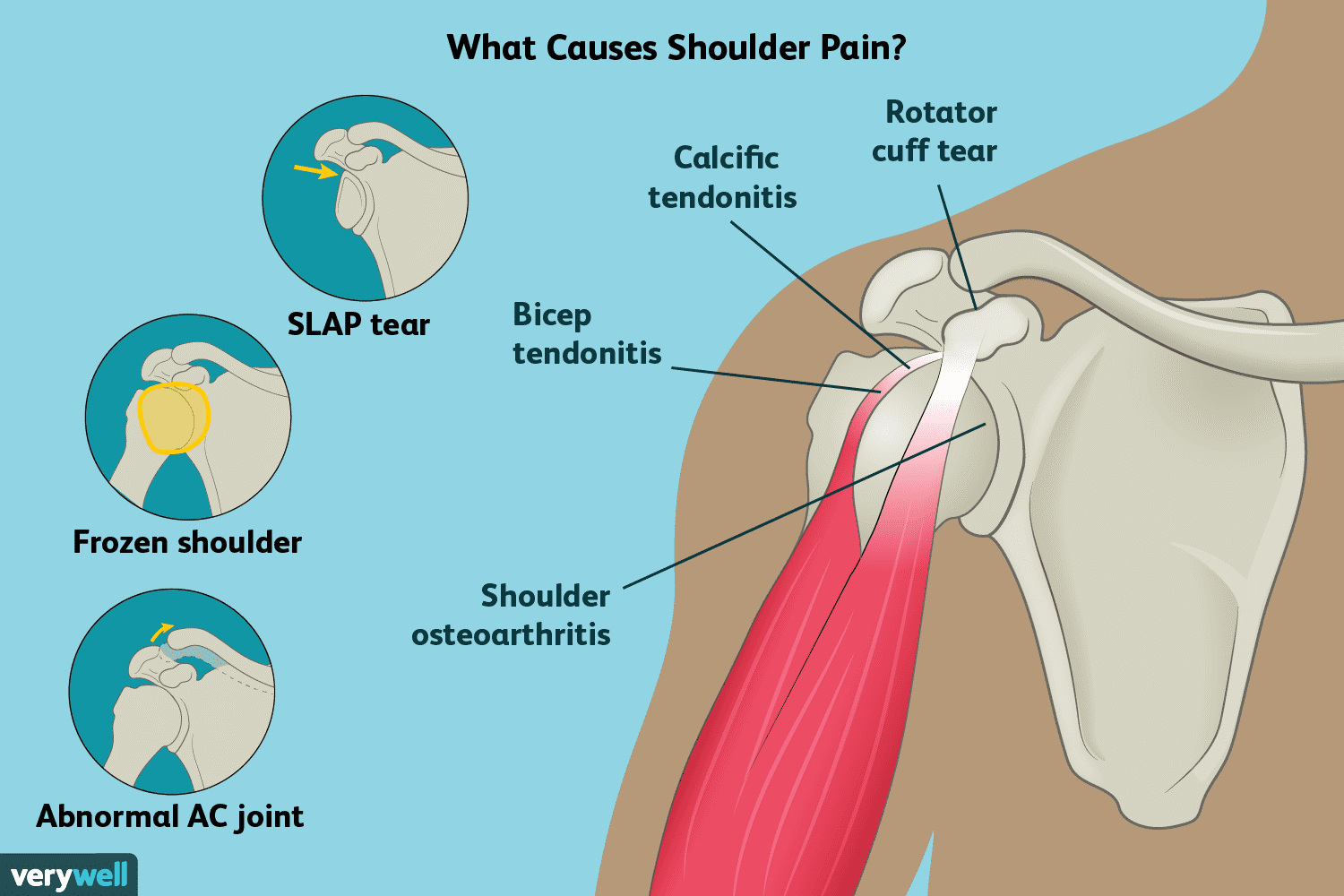 recovery time of stem cell therapy for shoulders