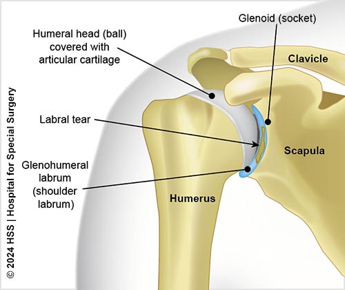 stem cell therapy for torn labrum